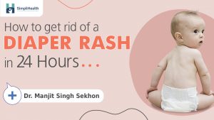 Diaper Rash Treatment