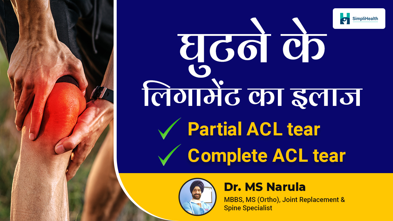 ACL Injury Treatment