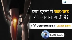 Osteoarthritis Treatment Symptoms