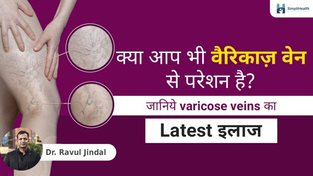 Varicose Veins by Dr. Ravul Jindal