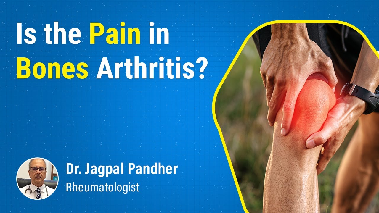 Rheumatoid Arthritis