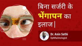Squint eye By Dr. Anin Sethi