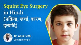 Squint Eye Surgery