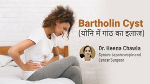 Bartholin Cyst Treatment | बार्थोलिन सिस्ट | योनि में गांठ के कारण व इलाज ? | What causes Bartholin Cyst?