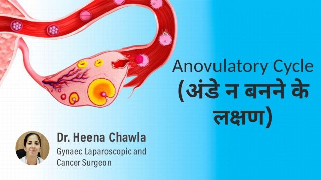 Symptoms of Anovulation