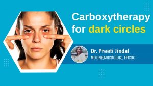 What is Carboxytherapy