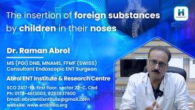 Foreign Body in Nose By Dr. Raman Abrol