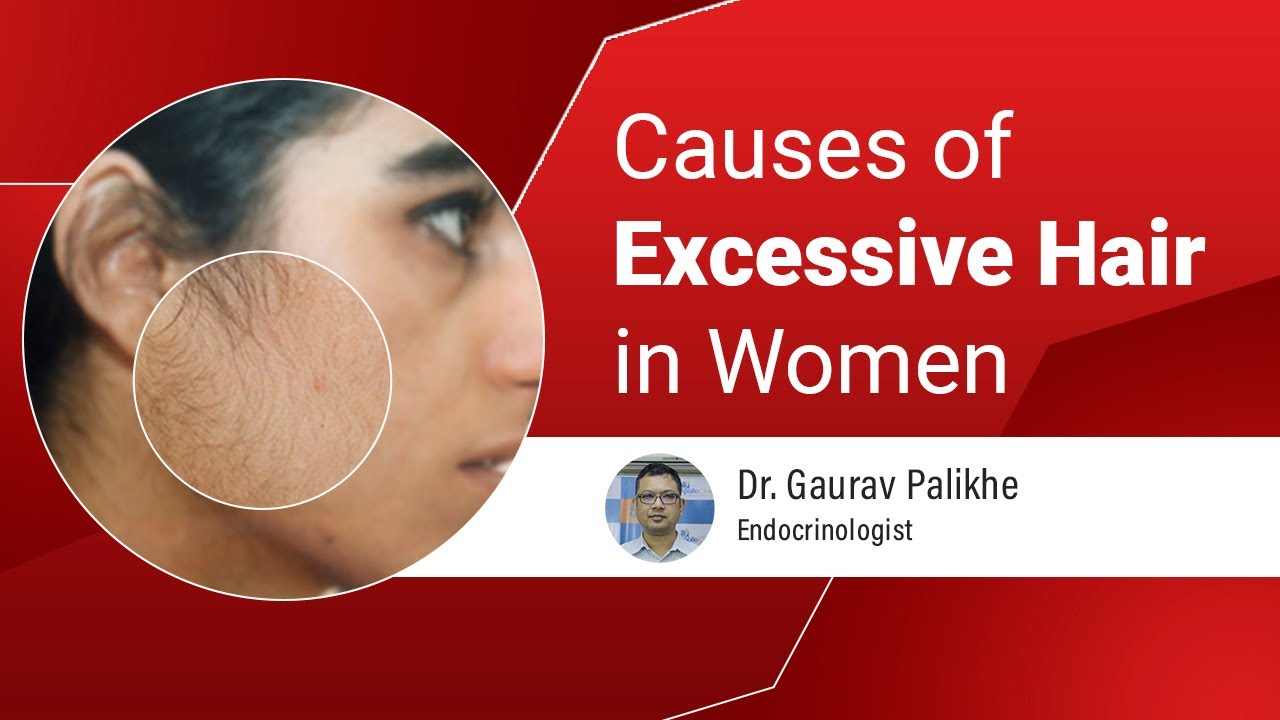 Facial Hair Growth- Hirsutism by Dr. Gaurav Palikhe