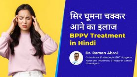 BPPV Treatment