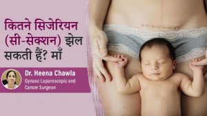 Number of C Sections or Cesareans by Dr. Heena Chawla