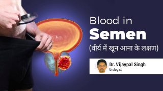 Blood in semen(Hematospermia)