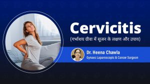 Treatment For Cervicitis | सर्विसाइटिस क्या है | Symptoms | Treatment