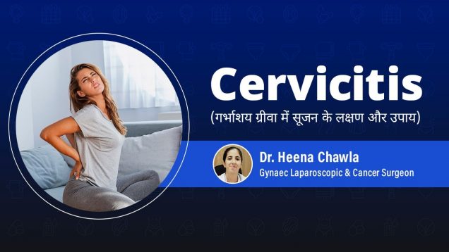 Treatment For Cervicitis
