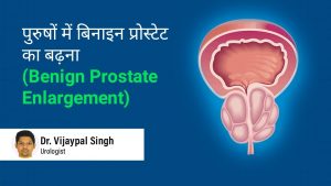 Benign Prostate Enlargement