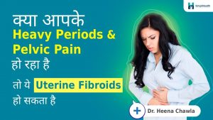 Best Treatment For Fibroids | फाइब्रॉएड के लिए सबसे अच्छा इलाज।| Uterine Fibroids | Causes, Symptoms, & Treatment  