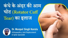 Rotator Cuff Injury Treatment | रोटेटर कफ इंजरी | Test & Risk Factors | कंधे के अंदर कैसे करें इससे बचाव?