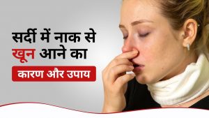 Reason for Nose Bleeding in Winter | नाक से ब्लीडिंग का उपचार | सर्दी जुकाम में नाक से खून आना? | नाक से खून आने का कारण और उपाय? | अचानक नाक से खून आना? | नाक से खून के थक्के आना?
