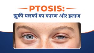 Ptosis (Droopy Eyelid): Causes, Symptoms & Treatment | पलकों के गिरने का क्या कारण है? | झुकी हुई पलकों को कैसे ठीक करें?