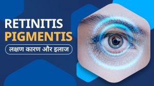 Retinitis Pigmentosa : Causes and Symptoms | Night Blindness | अंधता की बीमारी रेटिनाइटिस पिगमेंटोसा: कारण, लक्षण, इलाज