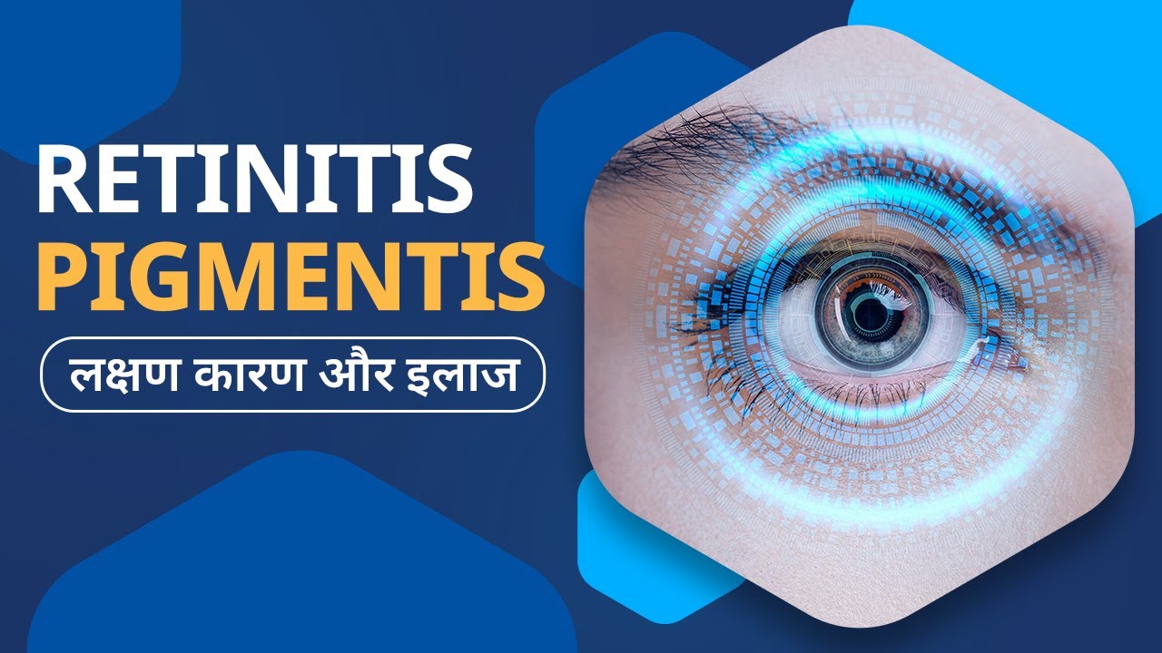 Retinitis Pigmentosa