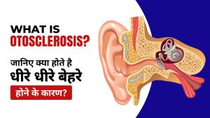 Otosclerosis : Symptoms and Treatment | Symptoms of Otosclerosis | धीरे-धीरे बहरापन  के लक्षण | कान से कम सुनाई देना उपचार | What is the main cause of otosclerosis? | What is otosclerosis symptoms and treatment? | Is otosclerosis Treatable?