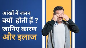 Burning Eyes: Symptoms, Causes and Treatment | आंखों में जलन और पानी आना | आंखो में जलन के लक्षण और बचाव के टिप्स | How Do You Get Rid of Hot Burning Eyes? What Helps Irritated Eyes in Summer? | How Can I Reduce My Eye Heat Naturally? How Do You Relieve Heat in Your Eyes?