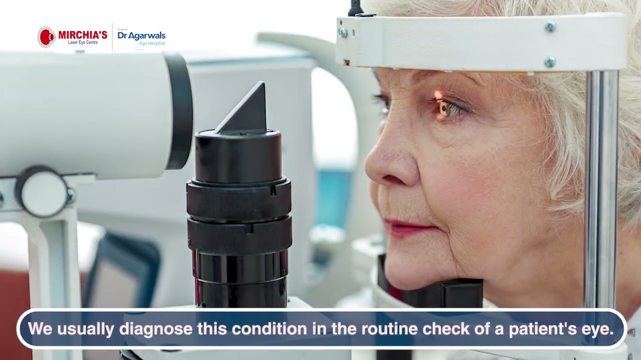 Posterior vitreous detachment symptoms