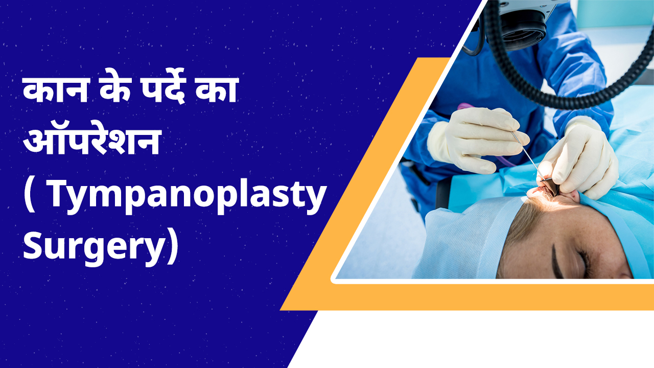 Tympanoplasty Surgery